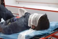 انفجار مواد محترقه دست ساز در دستان جوان ۲۱ ساله مرندی حادثه آفرید